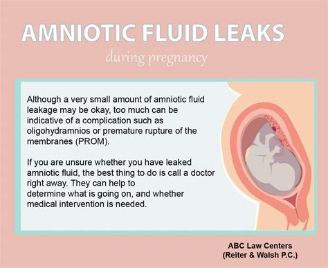 slow leak of amniotic fluid|Leaking Amniotic Fluid 